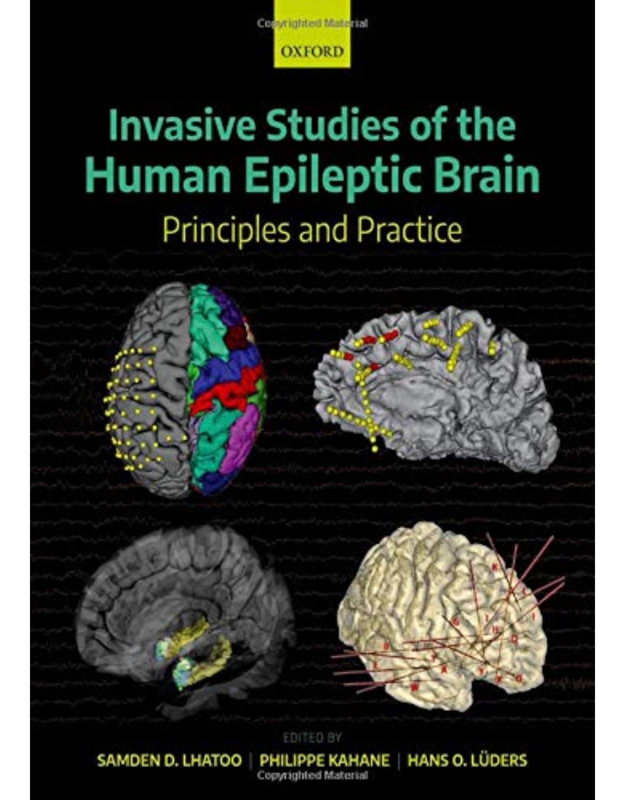 Invasive Studies of the Human Epileptic Brain: Principles and Practice