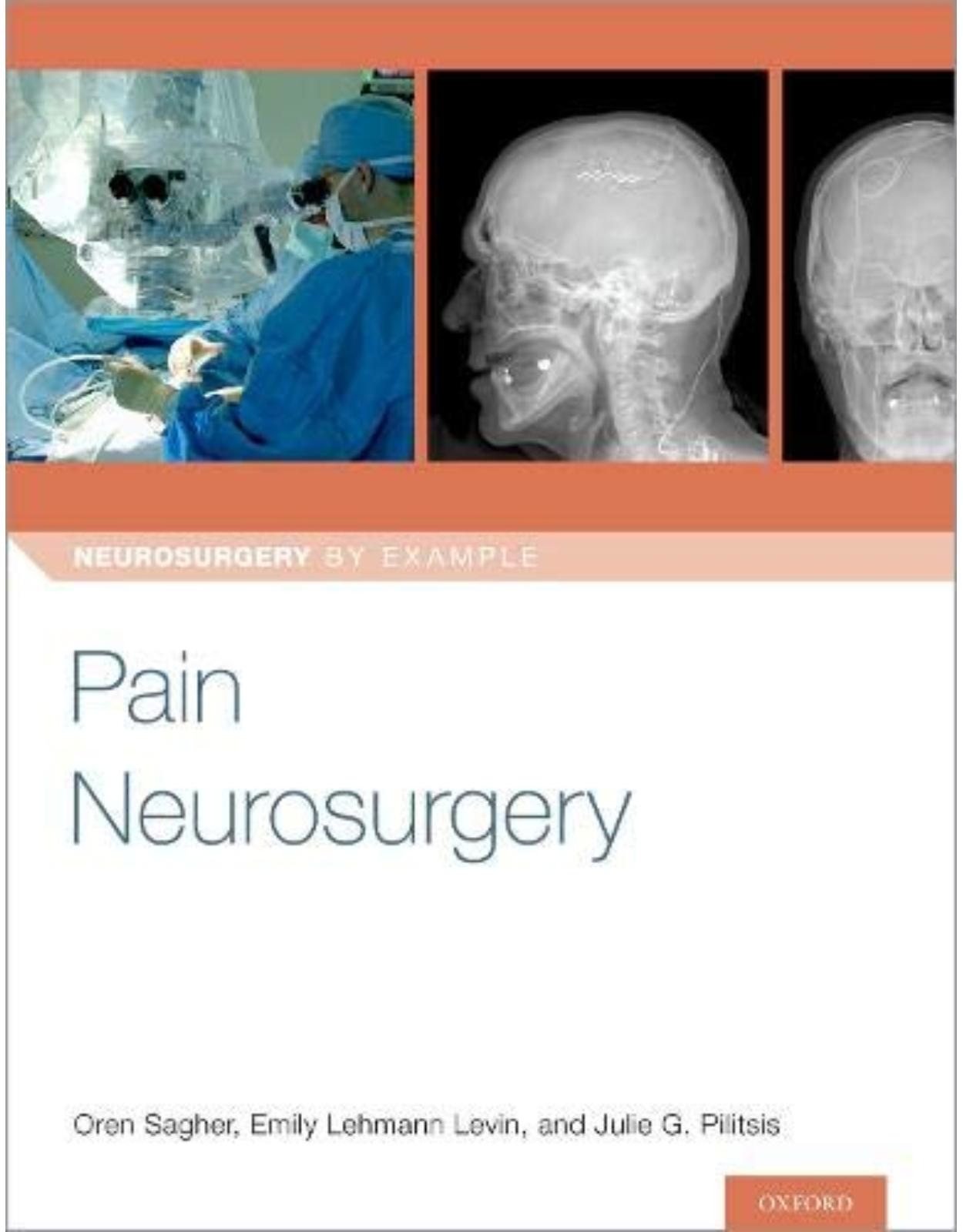 Pain Neurosurgery