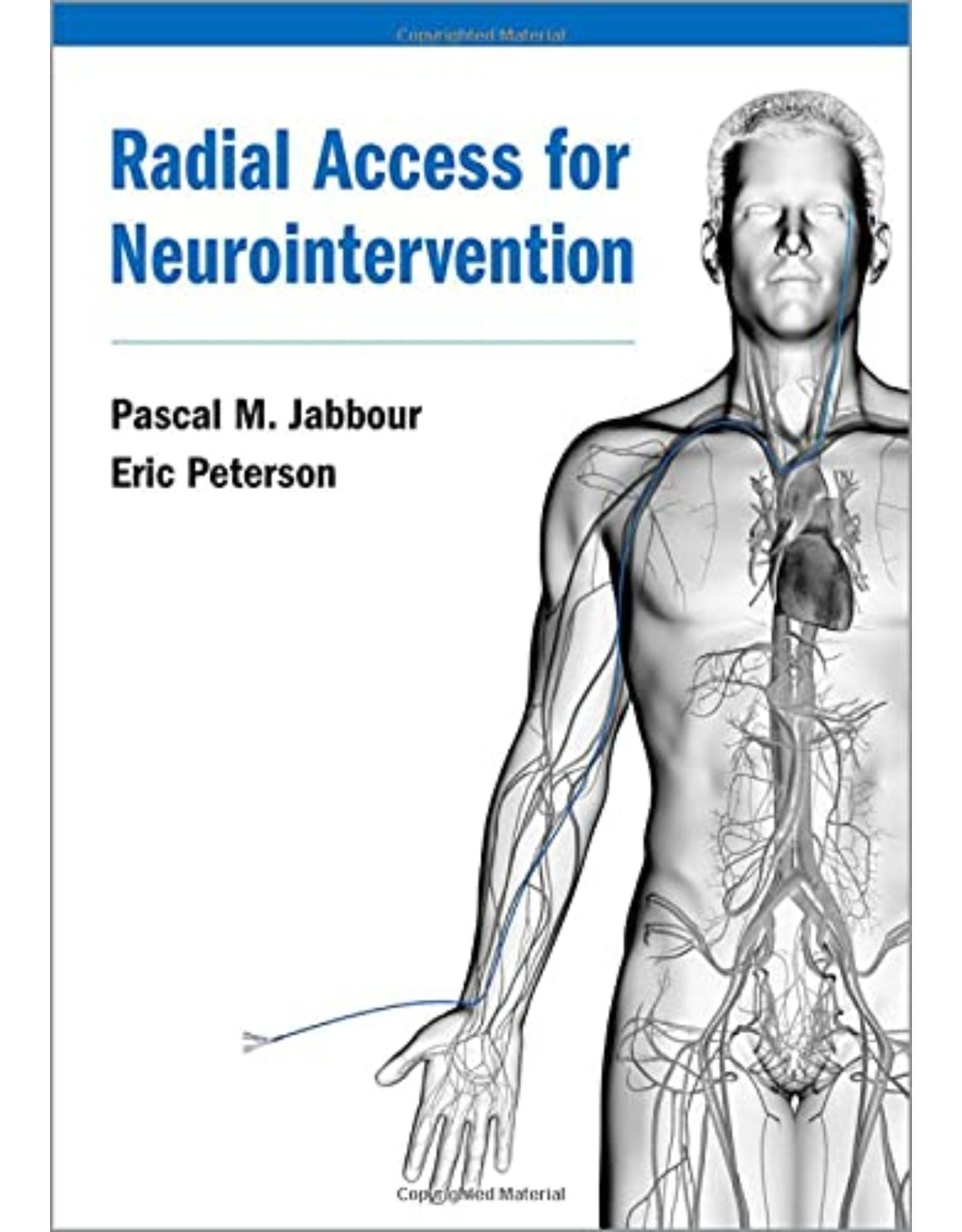 Radial Access for Neurointervention