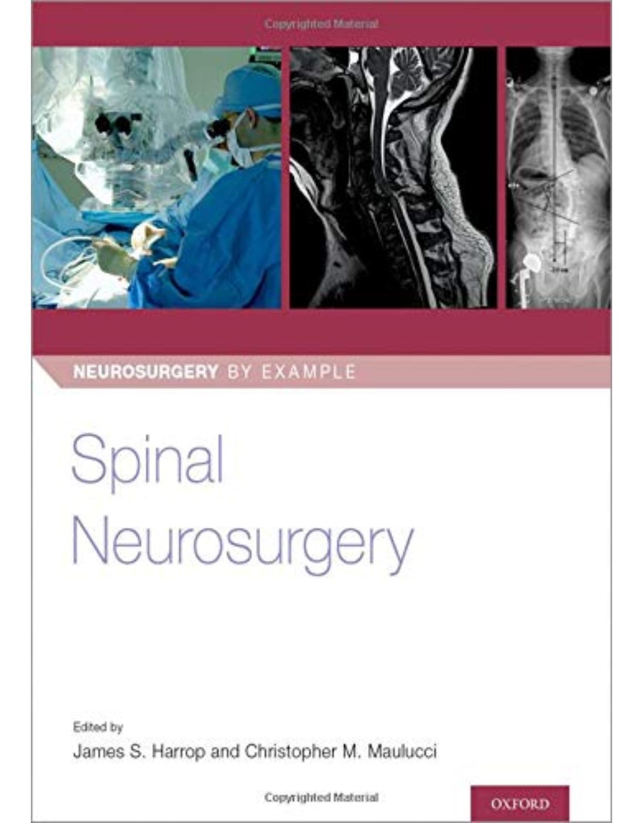 Spinal Neurosurgery