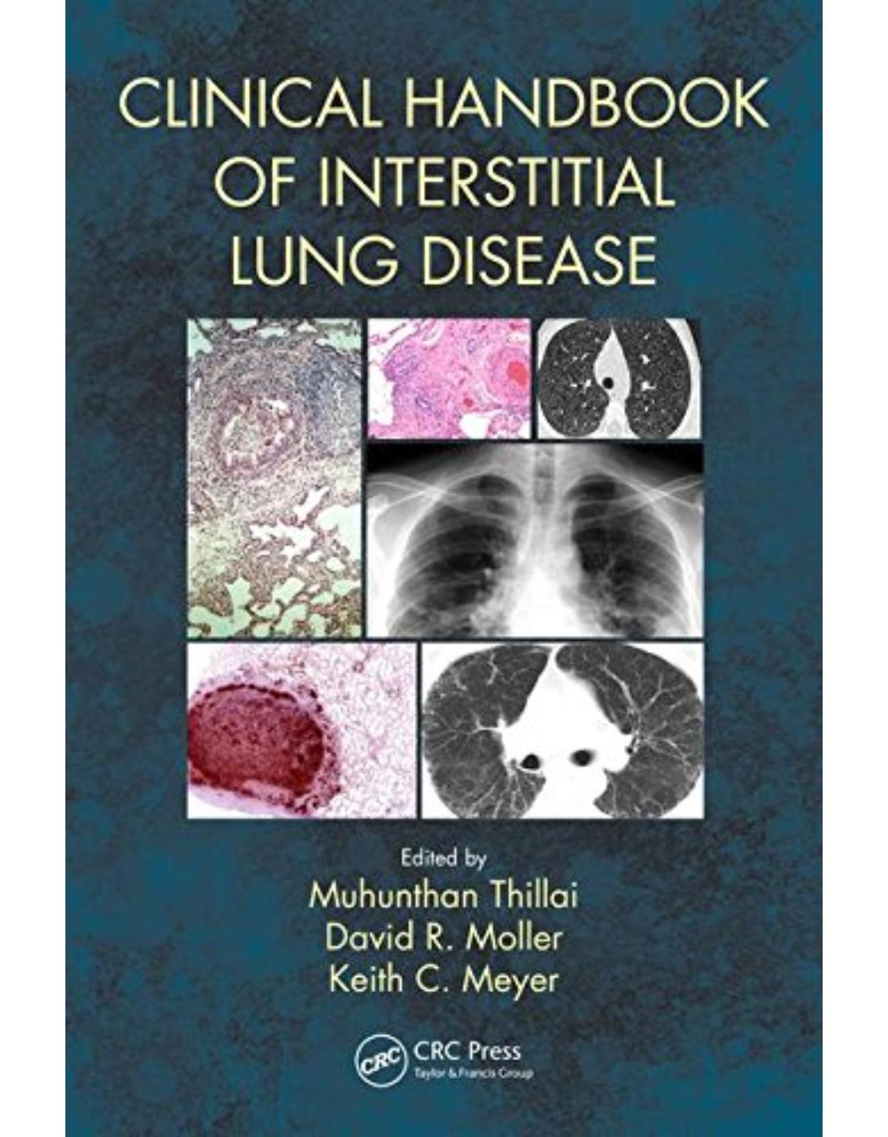 Clinical Handbook of Interstitial Lung Disease