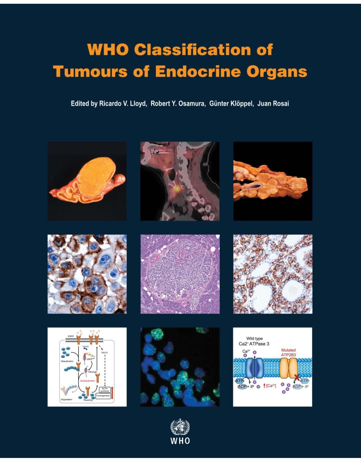 WHO classification of tumours of endocrine organs (World Health Organization Classification of Tumours)