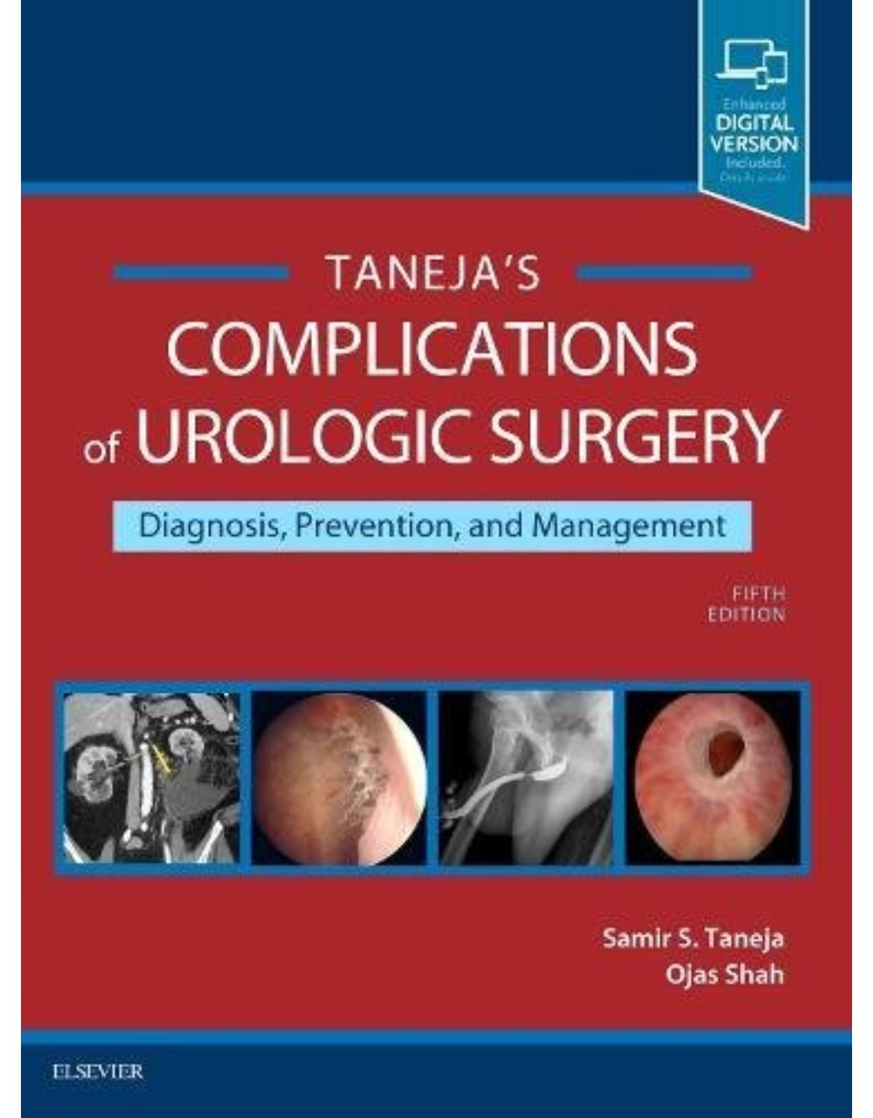 Complications of Urologic Surgery: Prevention and Management, 5e 