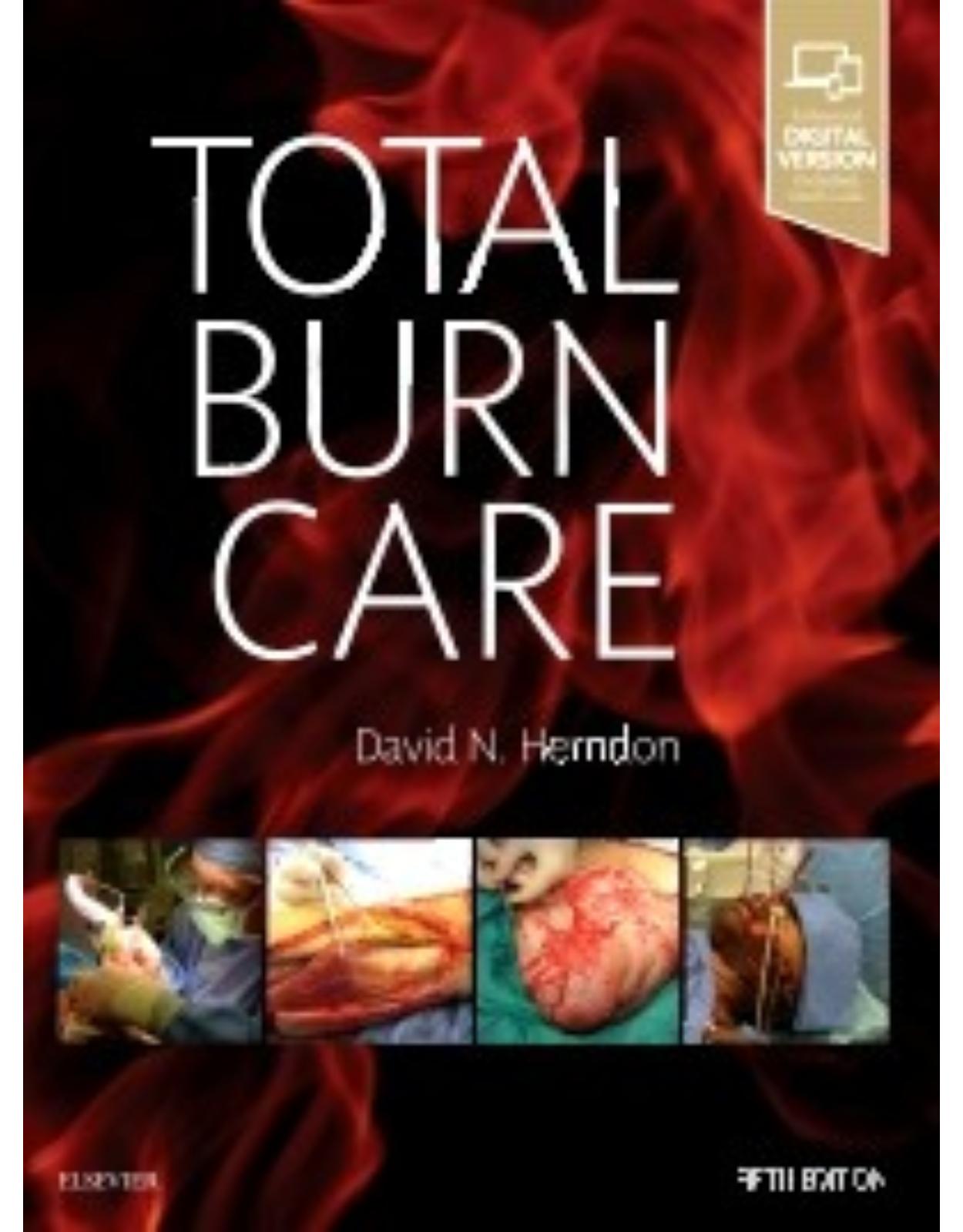 Total Burn Care, 5th Edition 