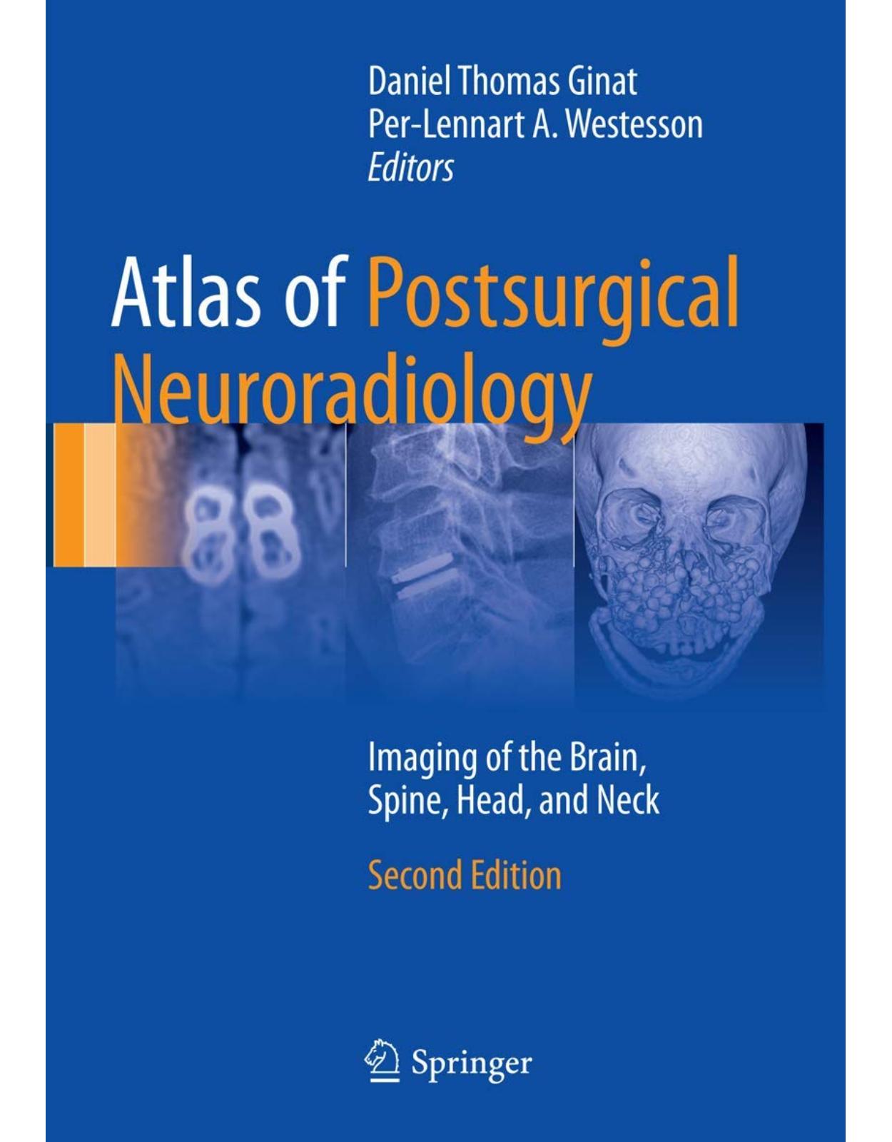 Atlas of Postsurgical Neuroradiology