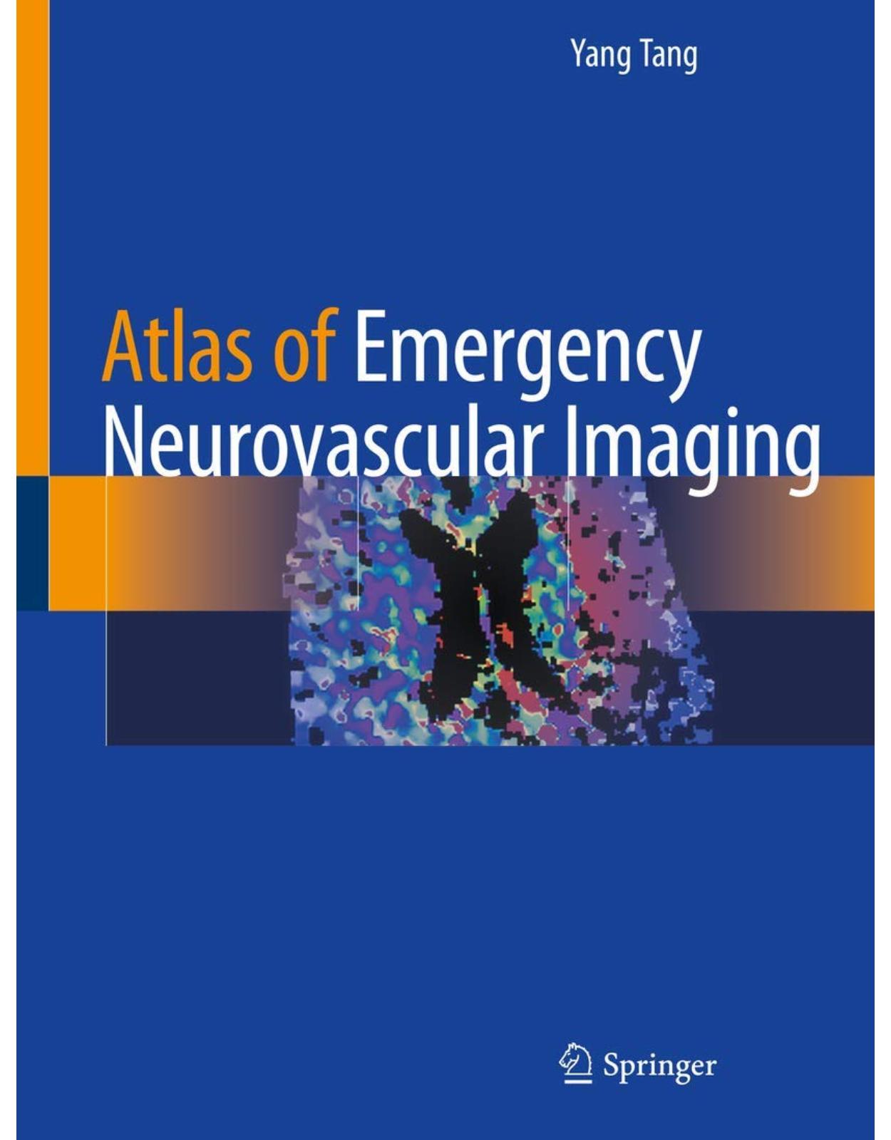 Atlas of Emergency Neurovascular Imaging