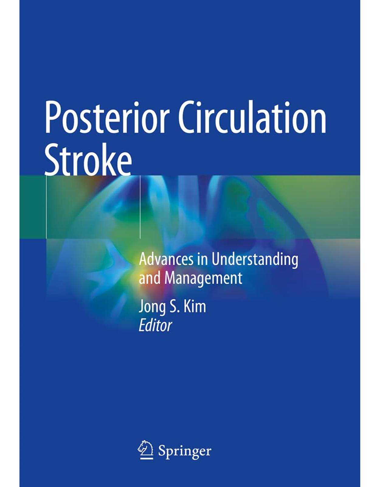 Posterior Circulation Stroke