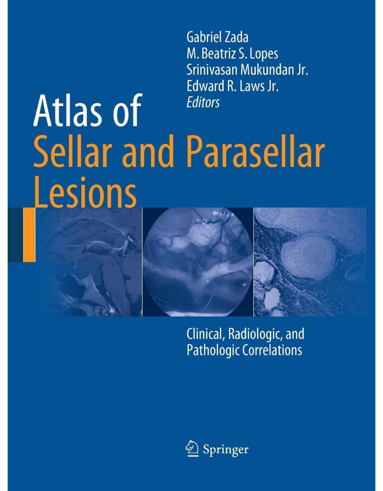 Atlas of Sellar and Parasellar Lesions