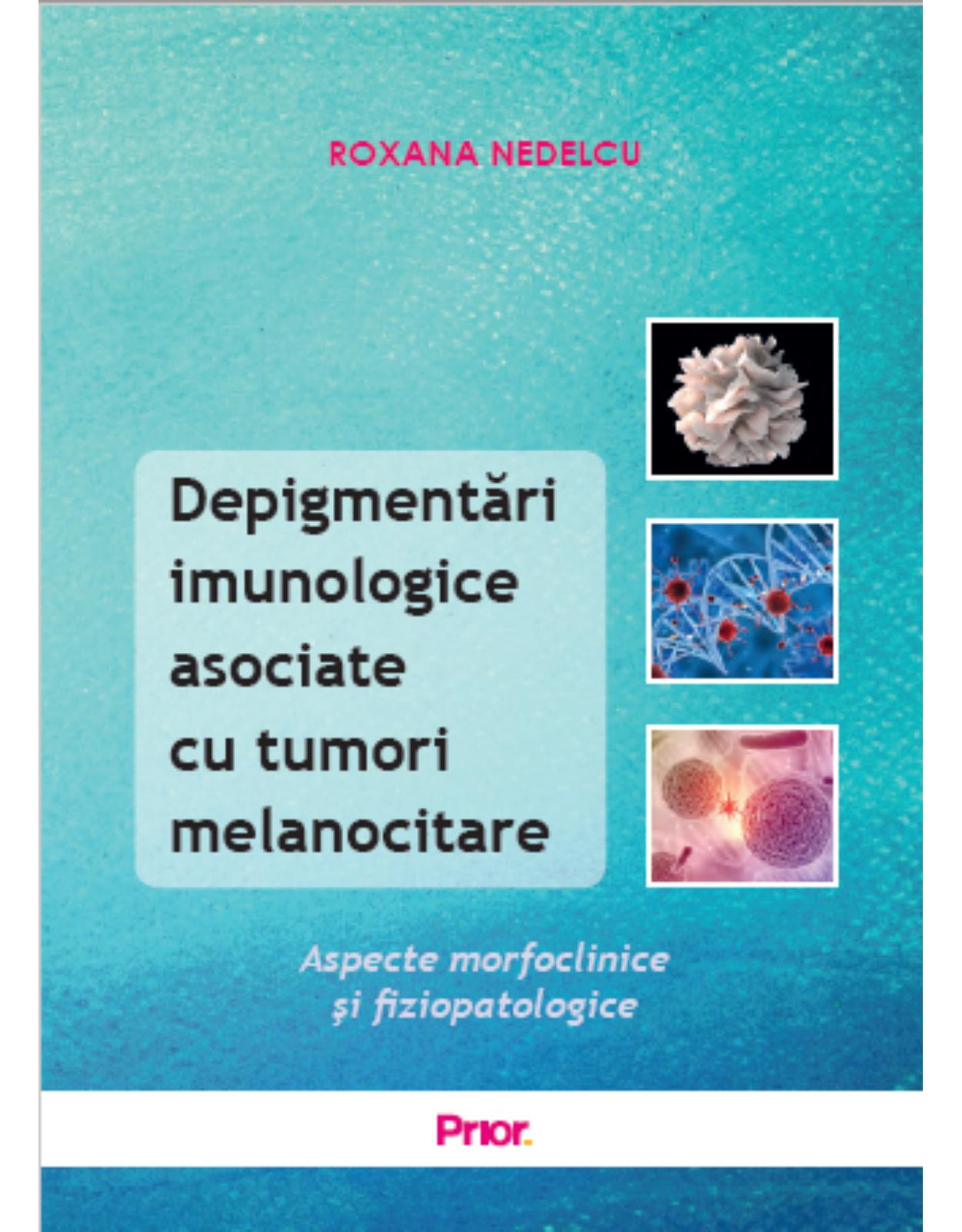 Depigmentari imunologice asociate cu tumori melanocitare
