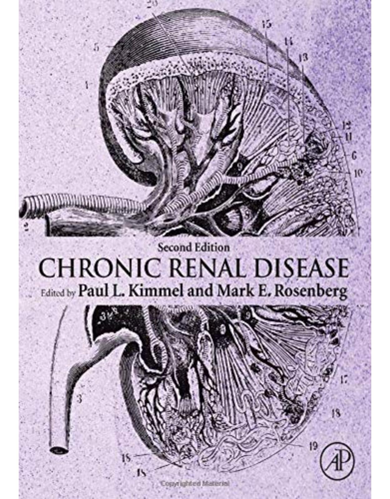 Chronic Renal Disease, 2nd Edition 