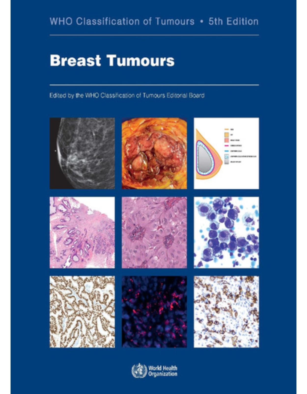 WHO Classification of Breast Tumours. Fifth Edition   