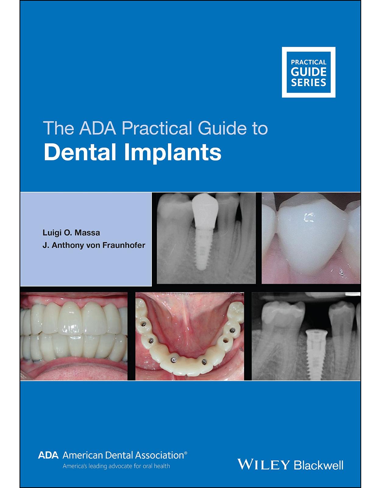 The ADA Practical Guide to Dental Implants