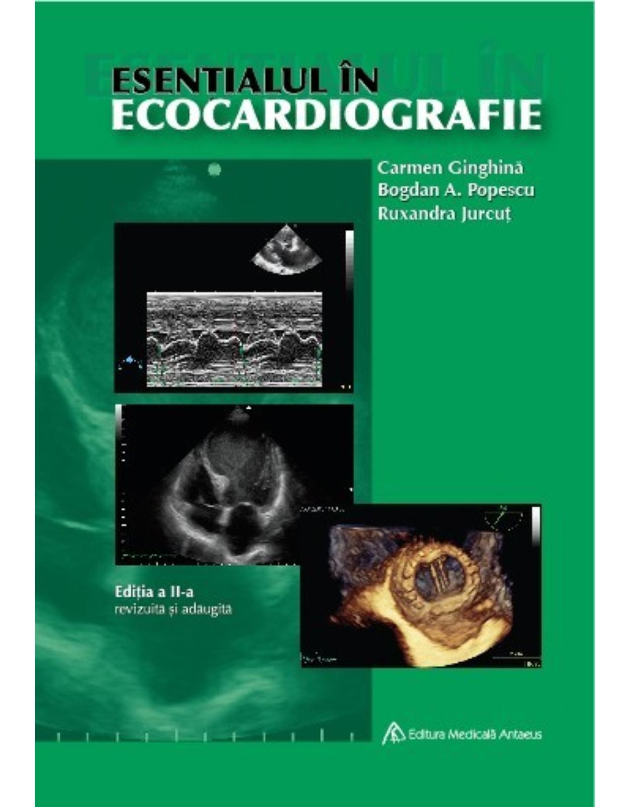 Esentialul in ecocardiografie, Editia a II-a revizuita si adaugita