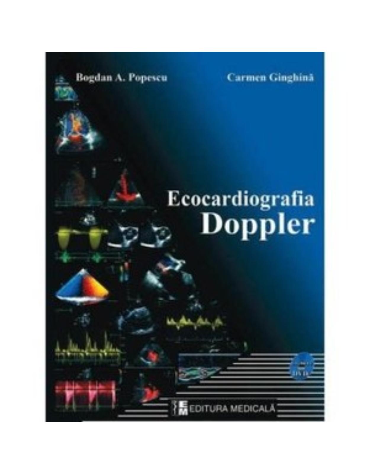 Ecocardiografia Doppler
