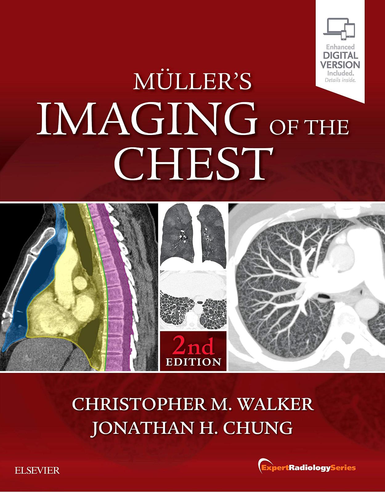 Muller's Imaging of the Chest: Expert Radiology Series, 2e 