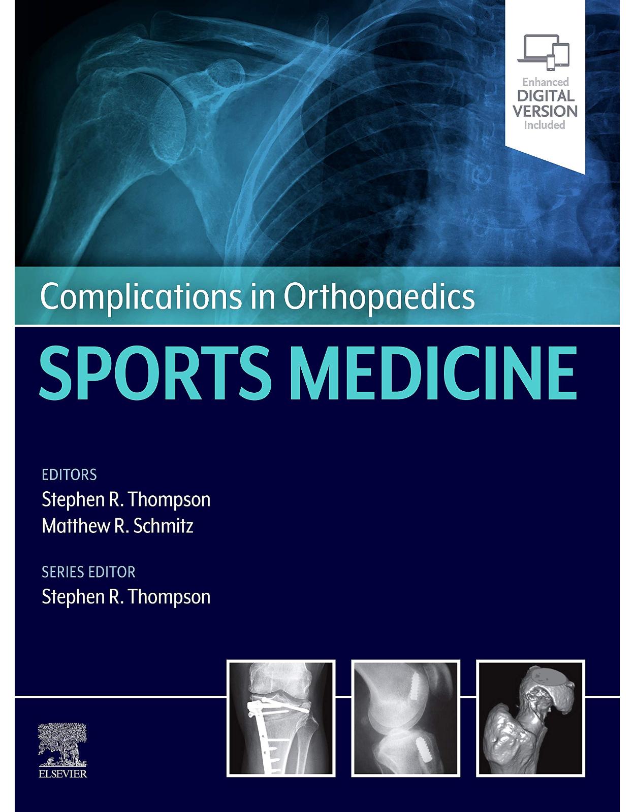 Complications in Orthopaedics: Sports Medicine 