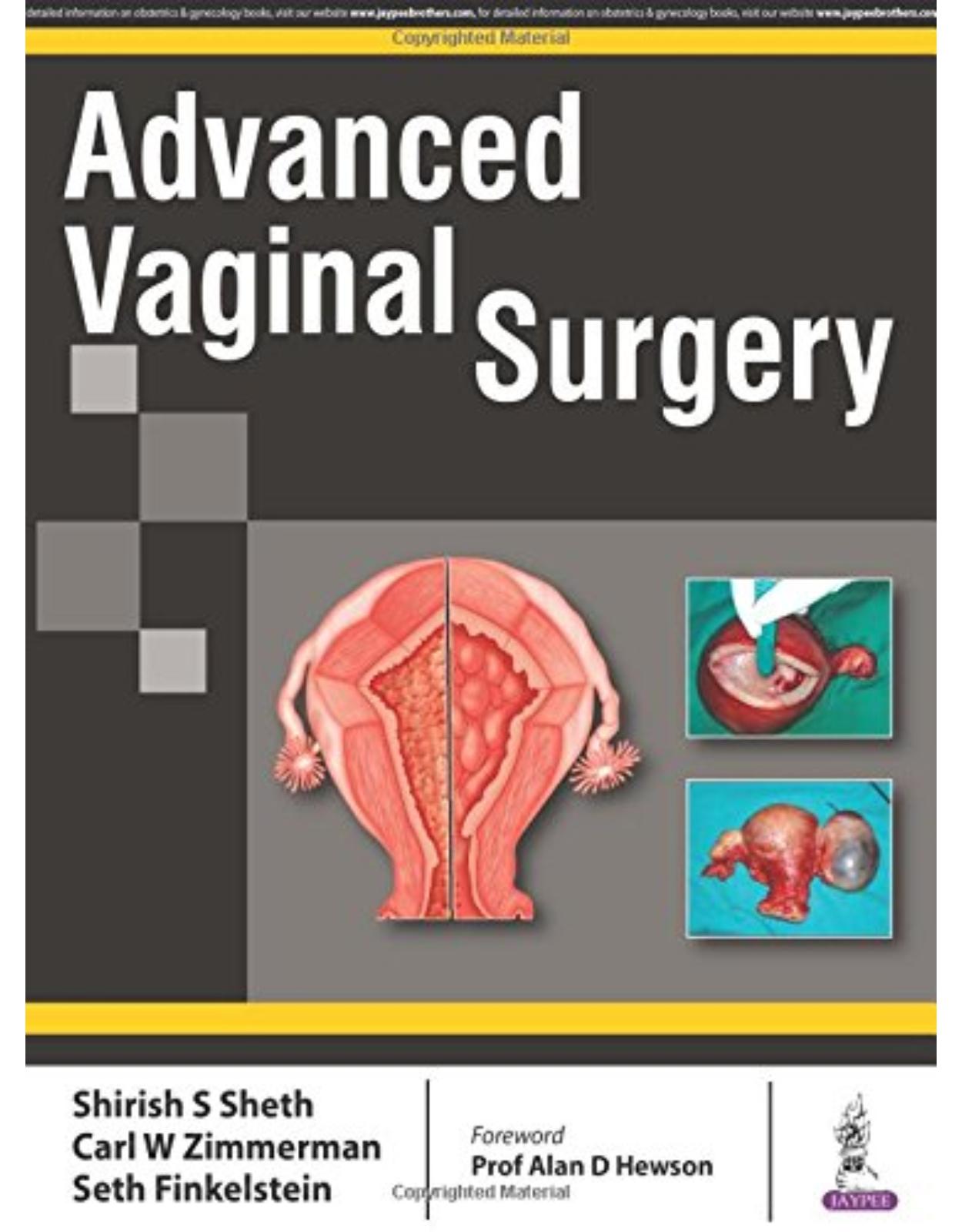 Advanced Vaginal Surgery