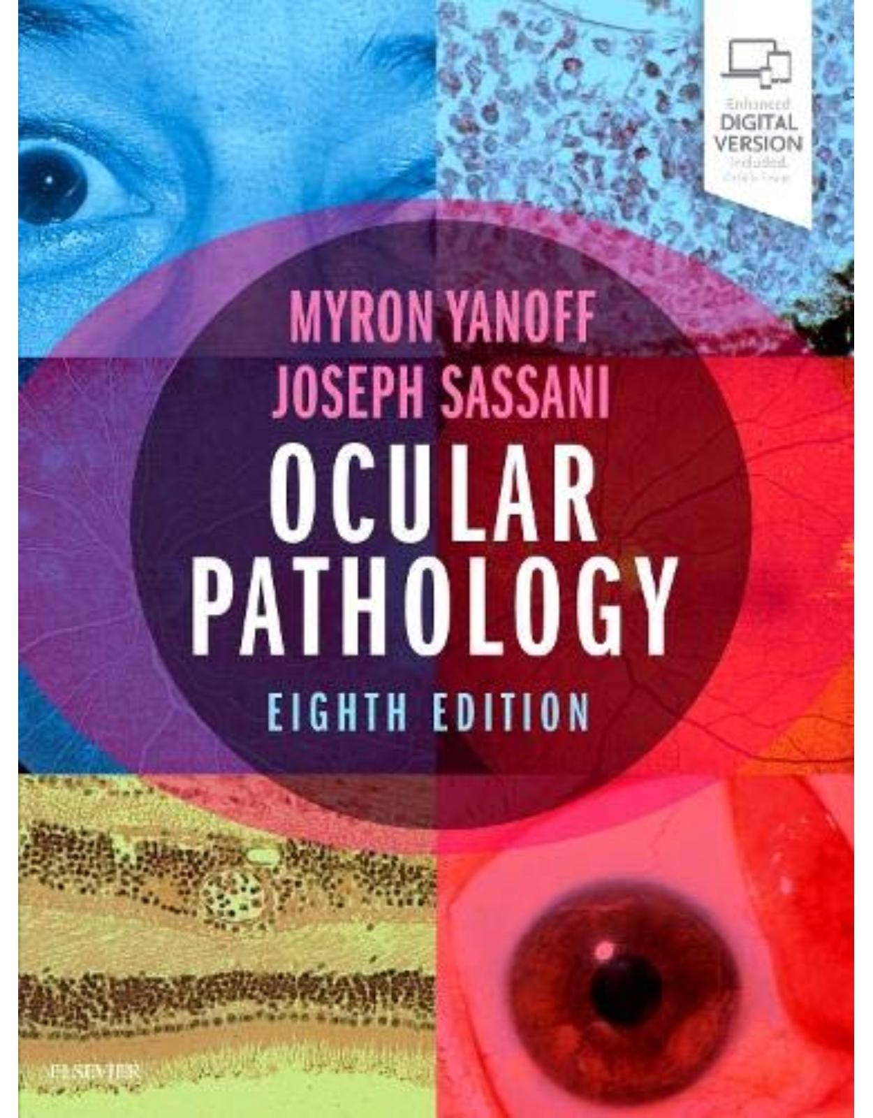 Ocular Pathology 