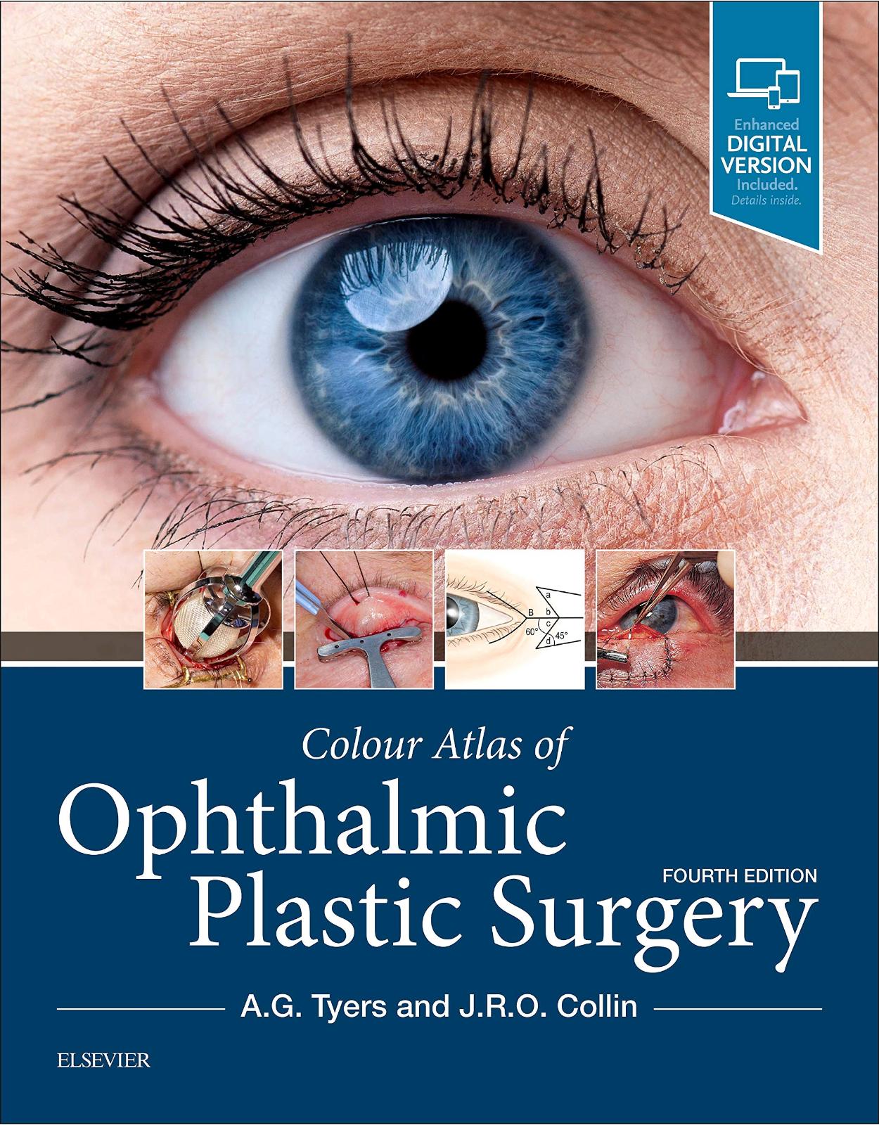 Colour Atlas of Ophthalmic Plastic Surgery, 4e