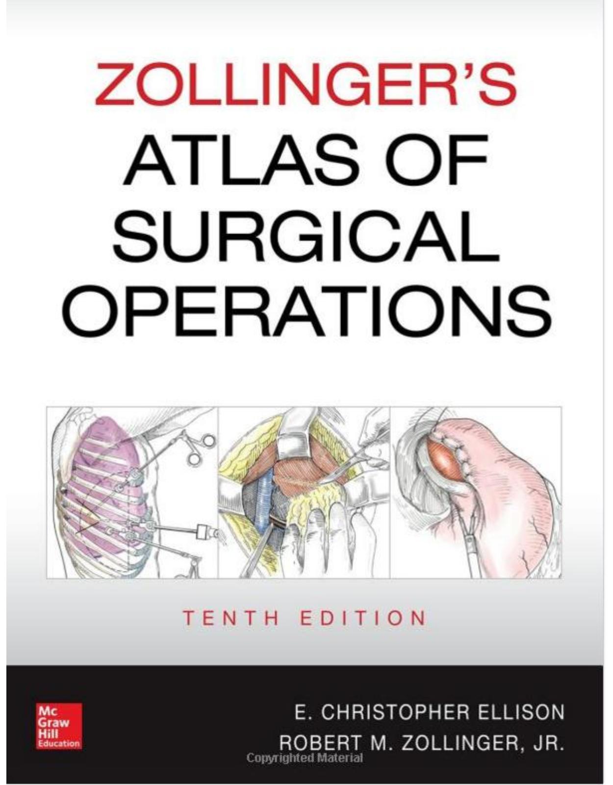 Zollinger’s Atlas of Surgical Operations, 10th edition