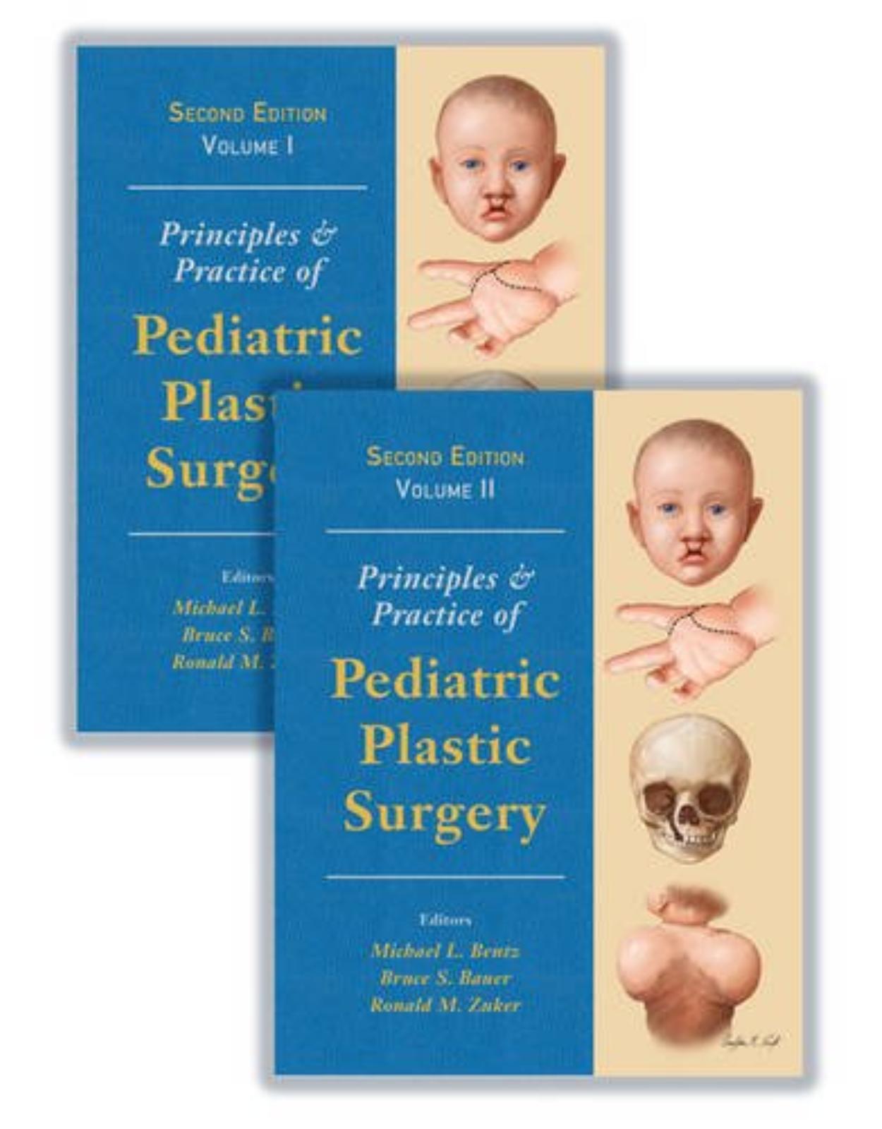 Principles and Practice of Pediatric Plastic Surgery, Second Edition - Two Volume Set