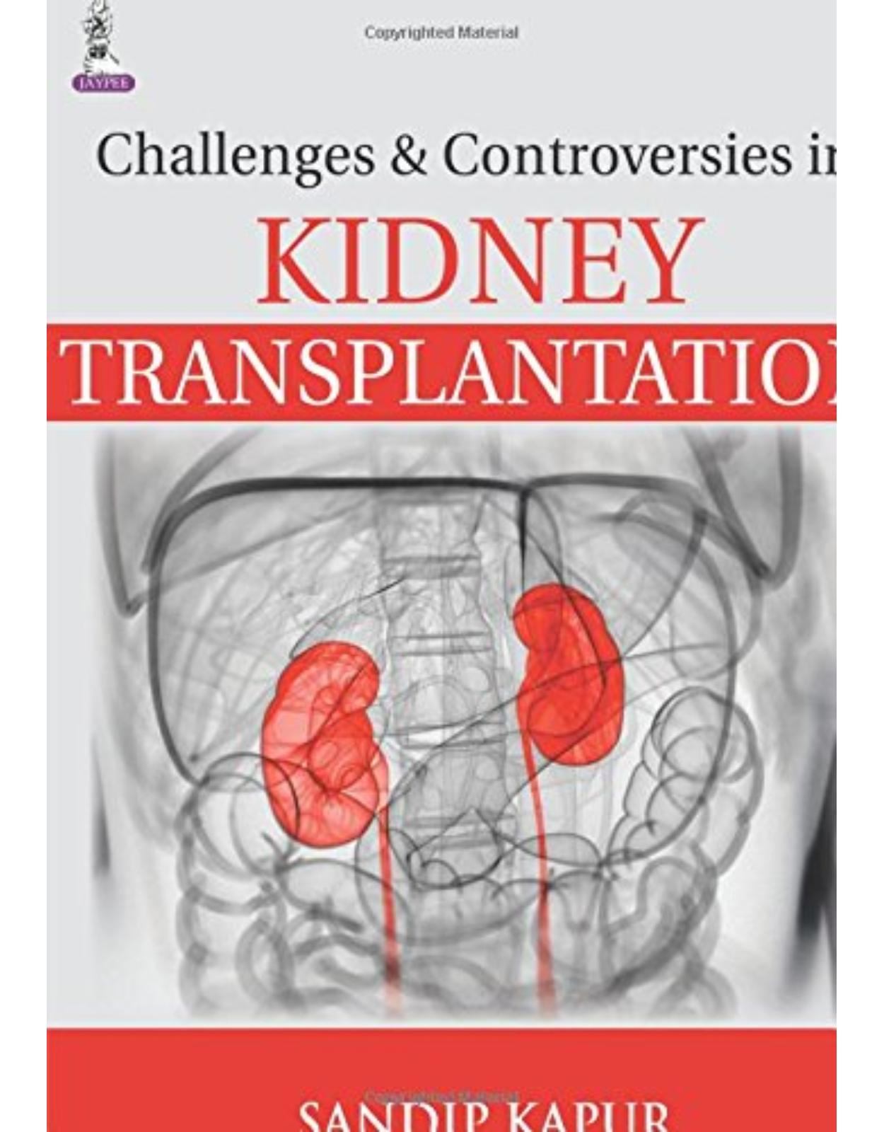 Challenges and Controversies in Kidney Transplantation