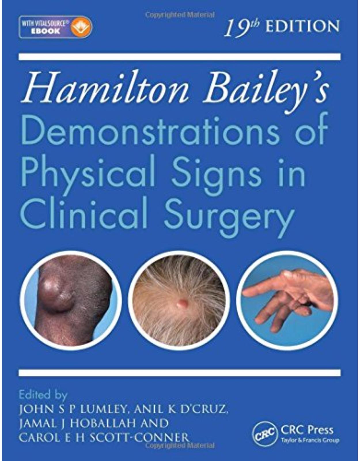 Hamilton Bailey s Physical Signs: Demonstrations of Physical Signs in Clinical Surgery, 19th Edition 