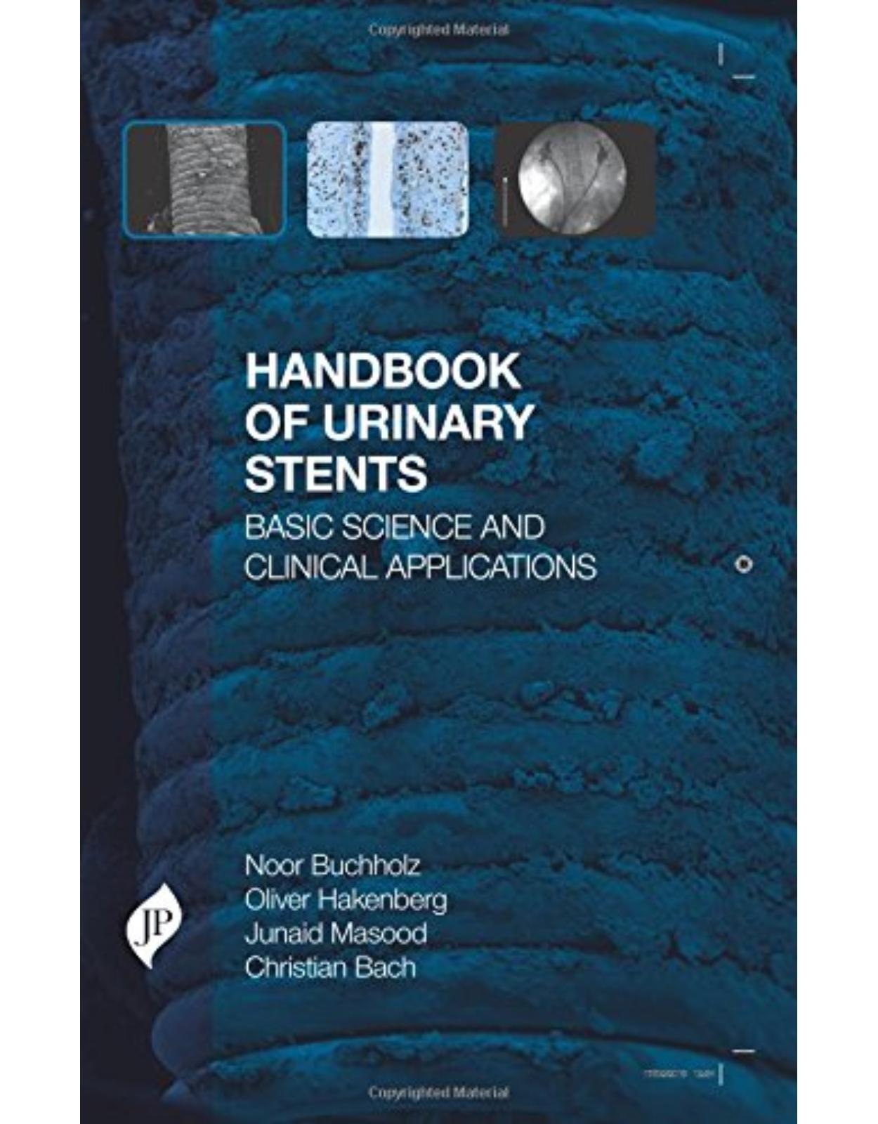 Handbook of Urinary Stents: Basic Science and Clinical Applications