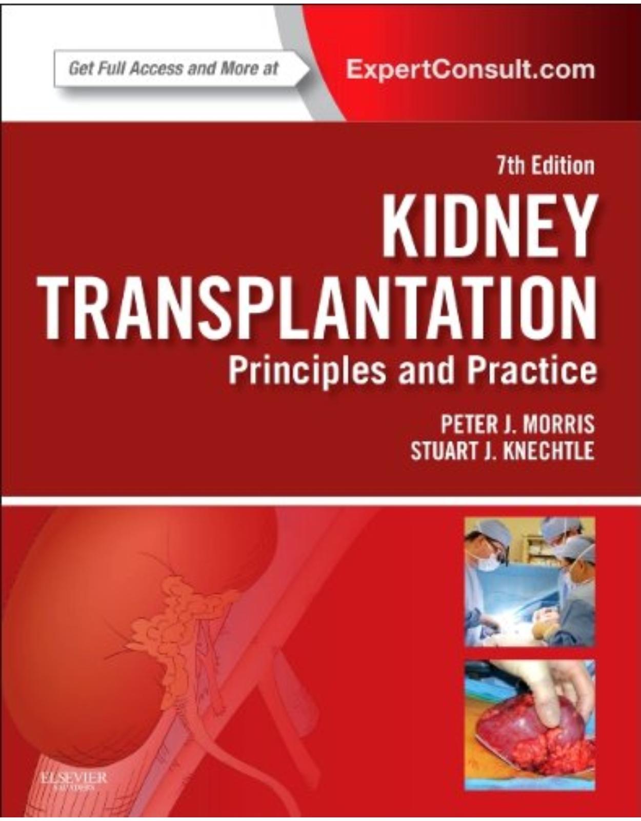 Kidney Transplantation - Principles and Practice, 7th Edition