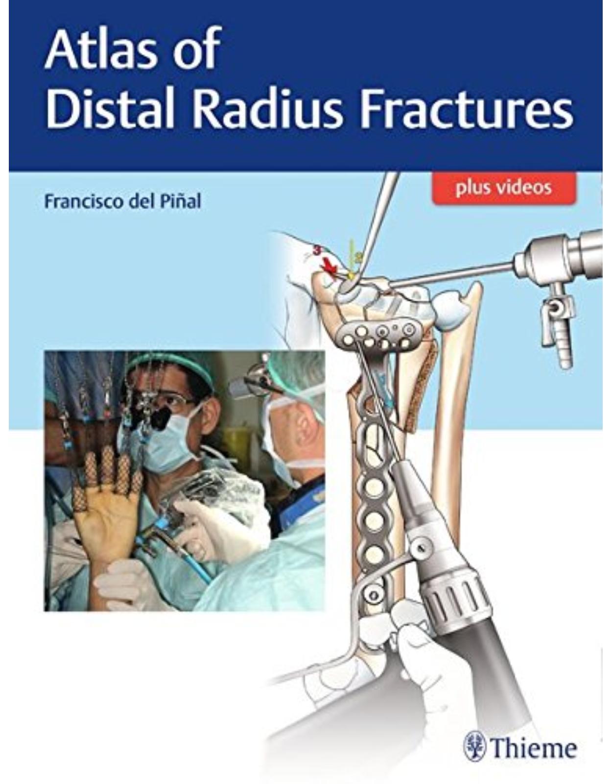 Atlas of Distal Radius Fractures