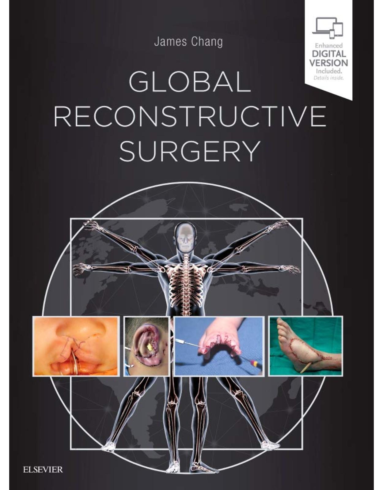 Global Reconstructive Surgery, 1e