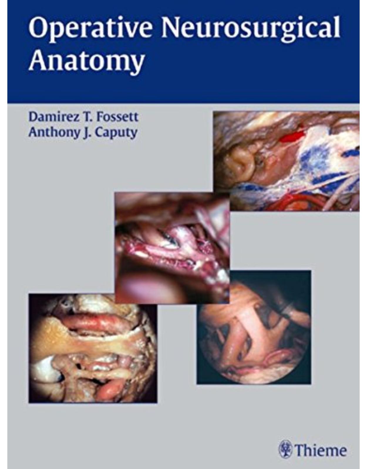  Operative Neurosurgical Anatomy
