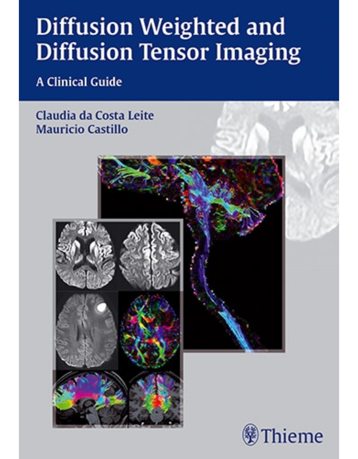 Diffusion Weighted and Diffusion Tensor Imaging: A Clinical Guide
