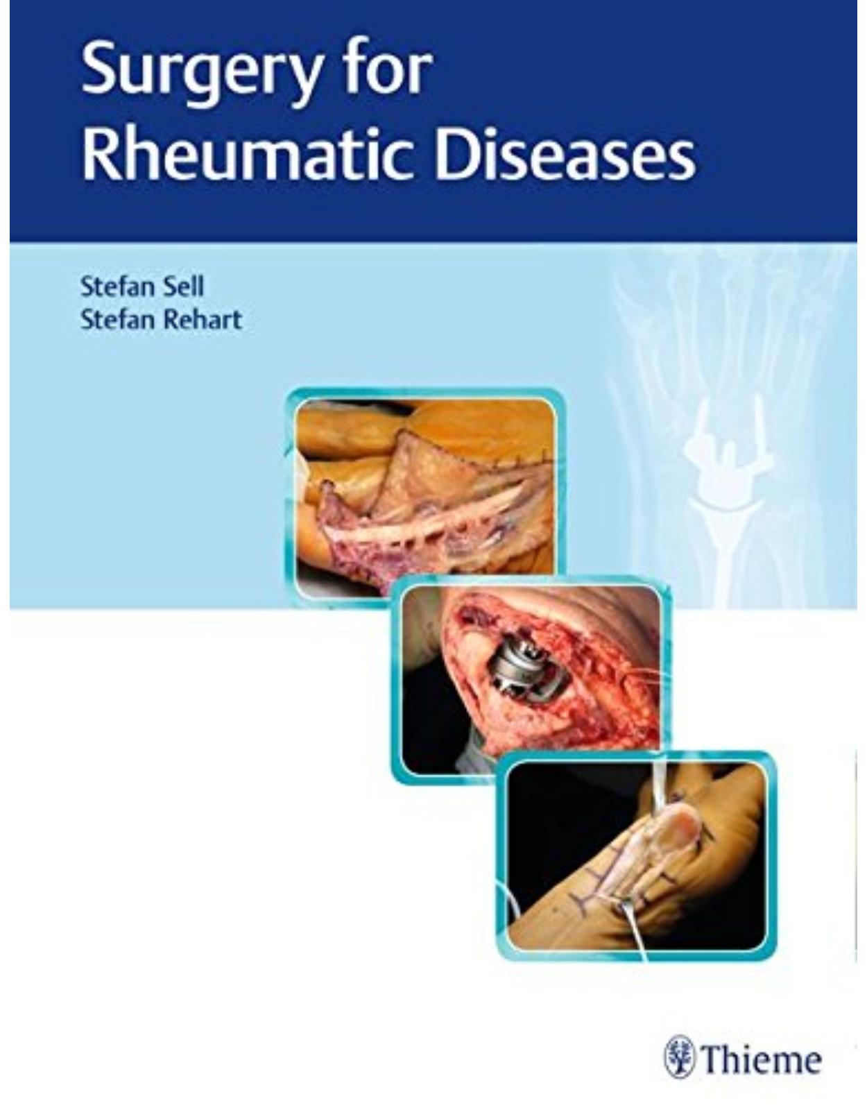  Surgery for Rheumatic Diseases