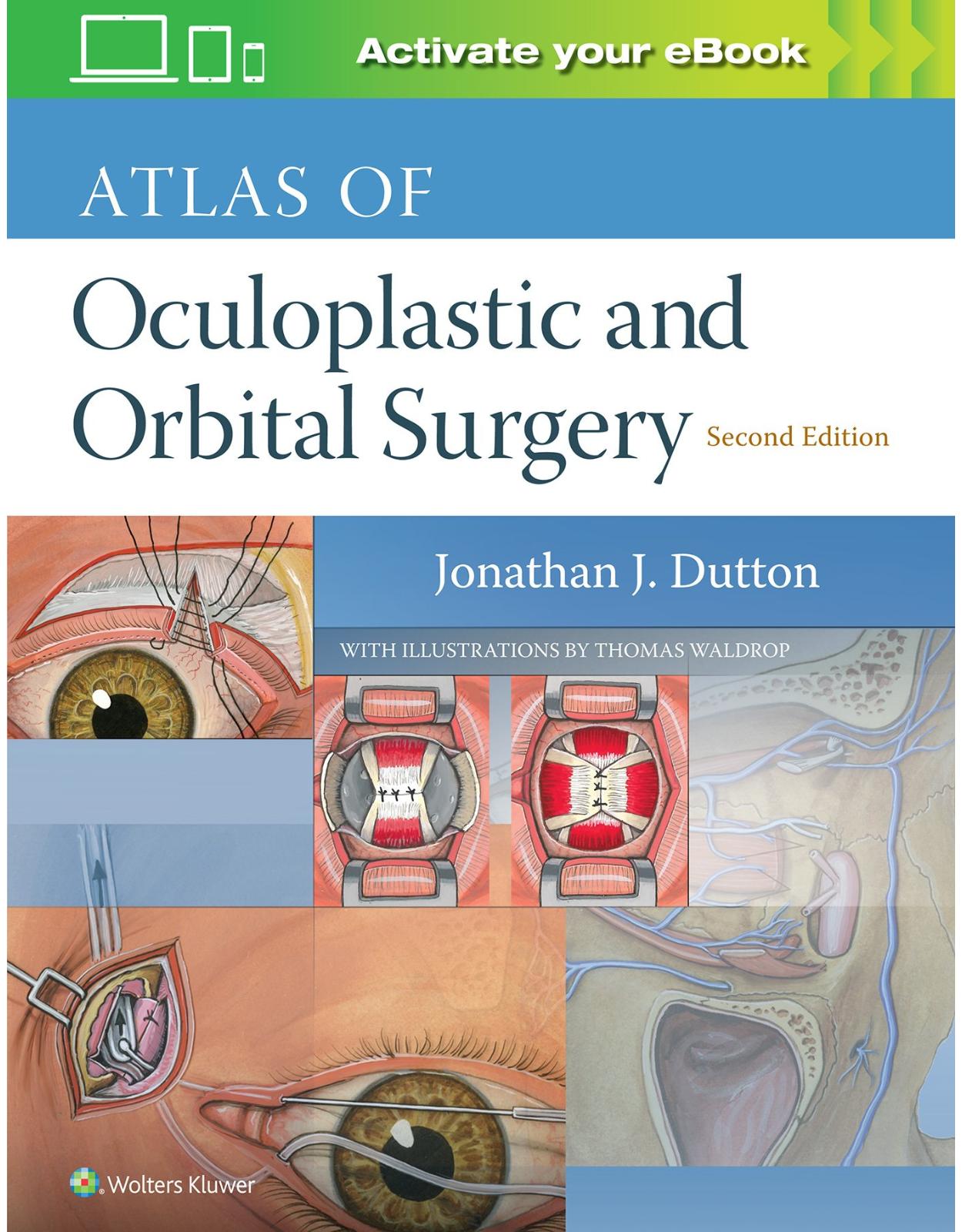 Atlas of Oculoplastic and Orbital Surgery