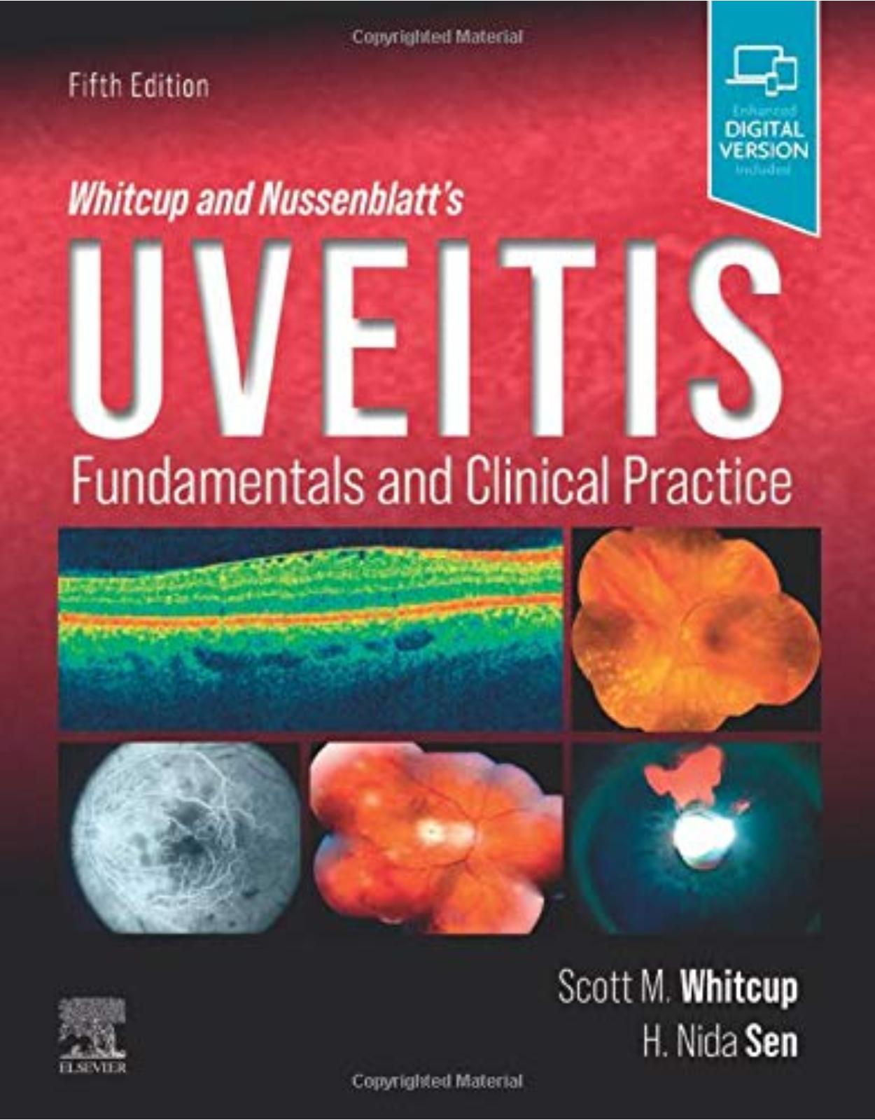 Whitcup and Nussenblatt’s Uveitis: Fundamentals and Clinical Practice 
