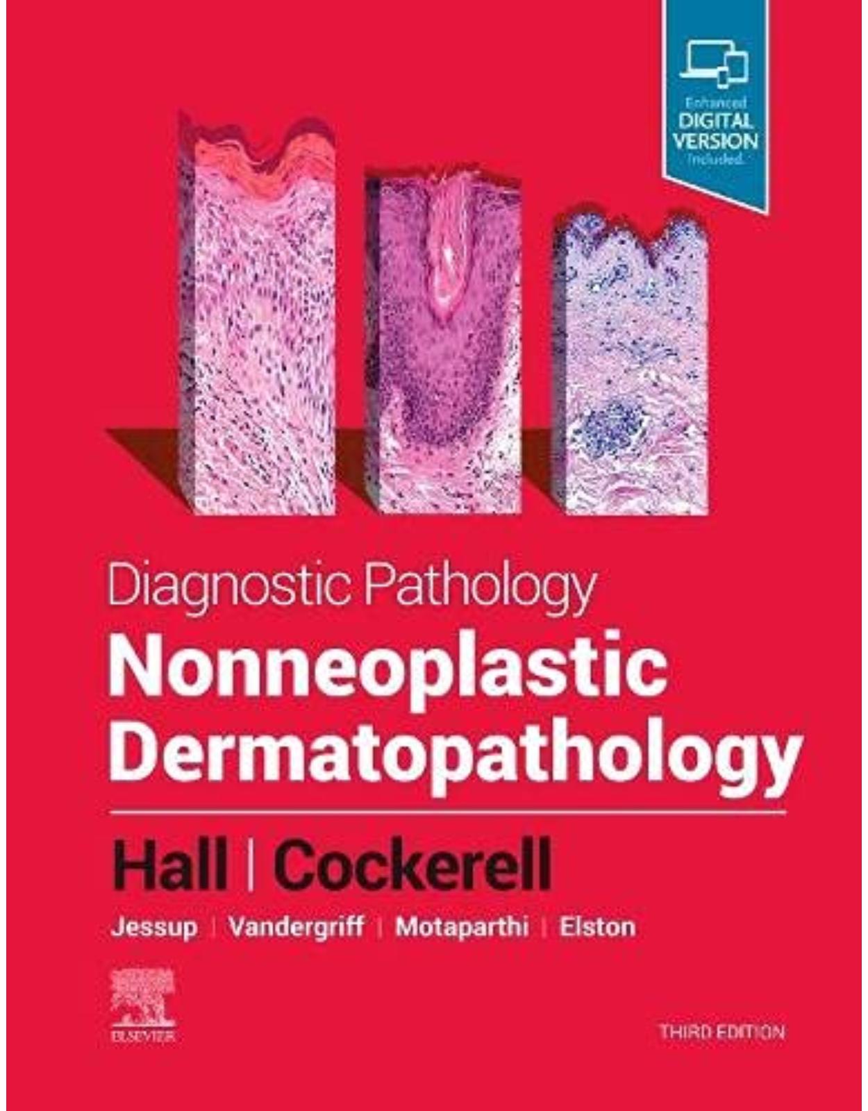 Diagnostic Pathology: Nonneoplastic Dermatopathology 