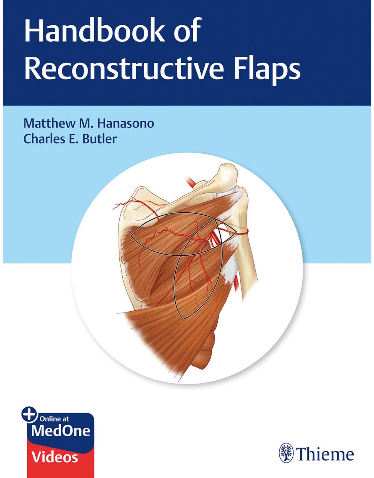 Handbook of Reconstructive Flaps