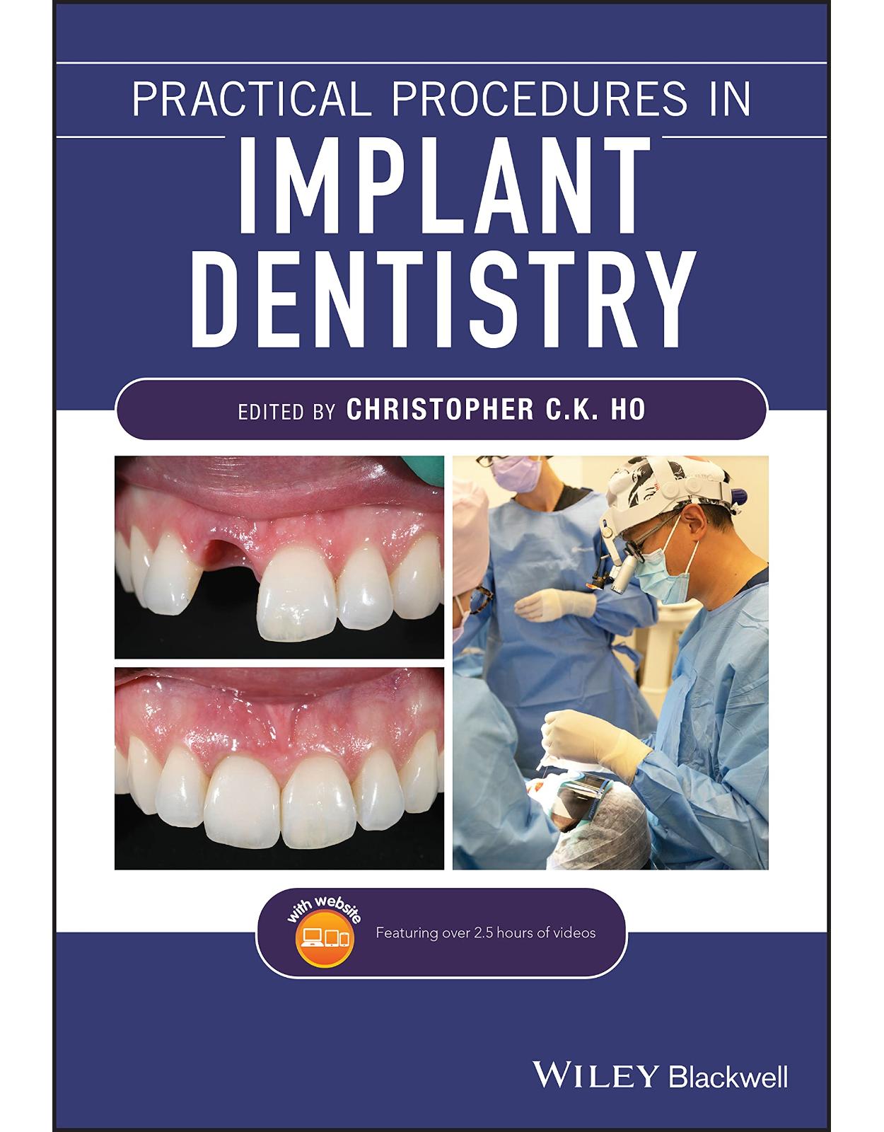 Practical Procedures in Implant Dentistry