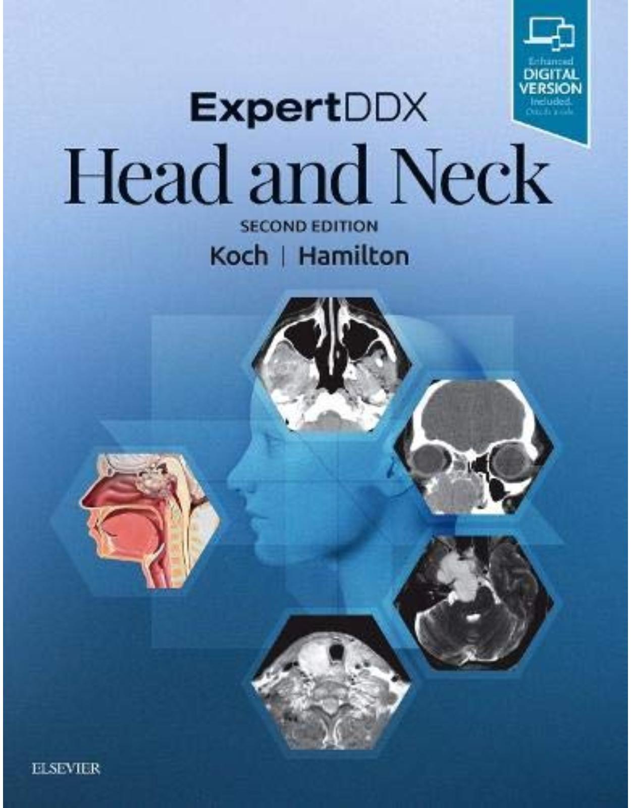 ExpertDDX: Head and Neck, 2e