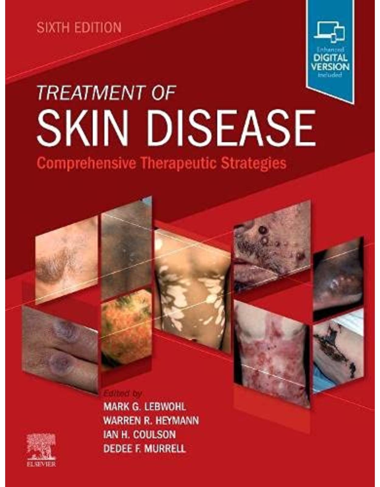 Treatment of Skin Disease: Comprehensive Therapeutic Strategies