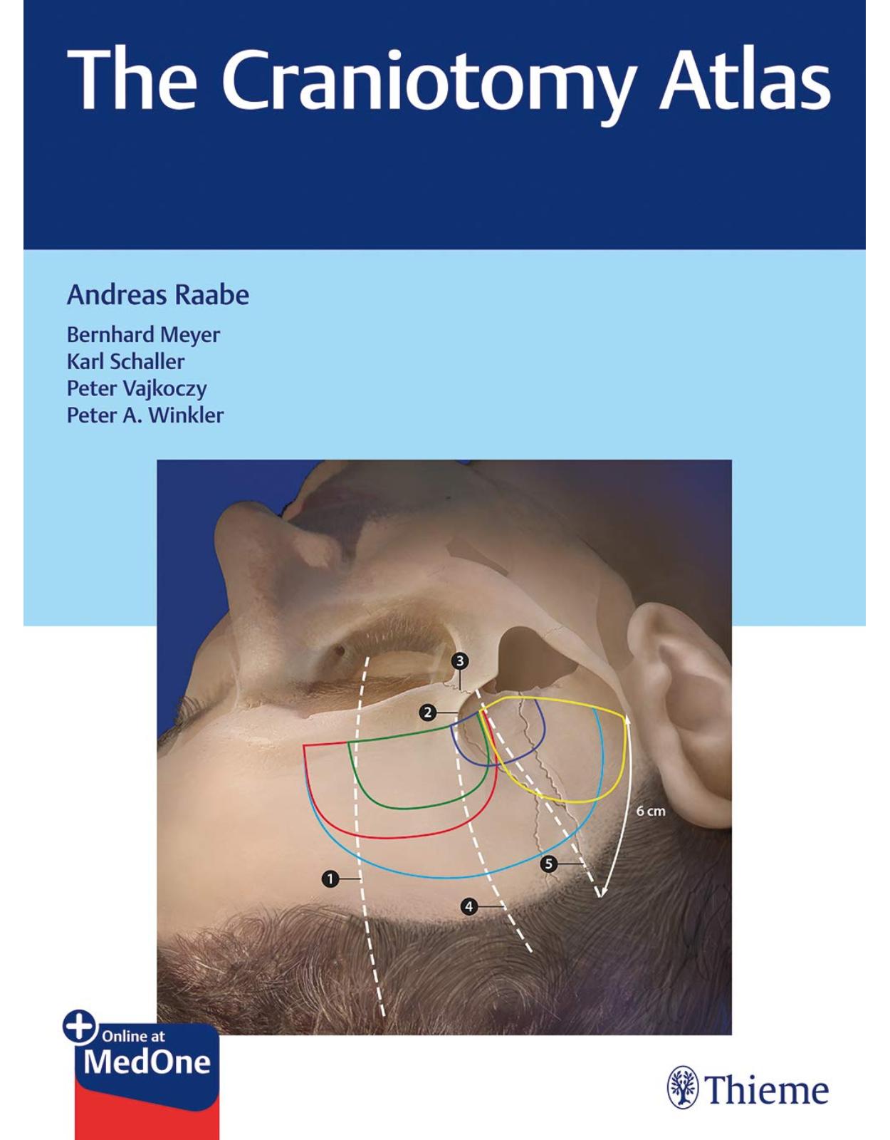 The Craniotomy Atlas