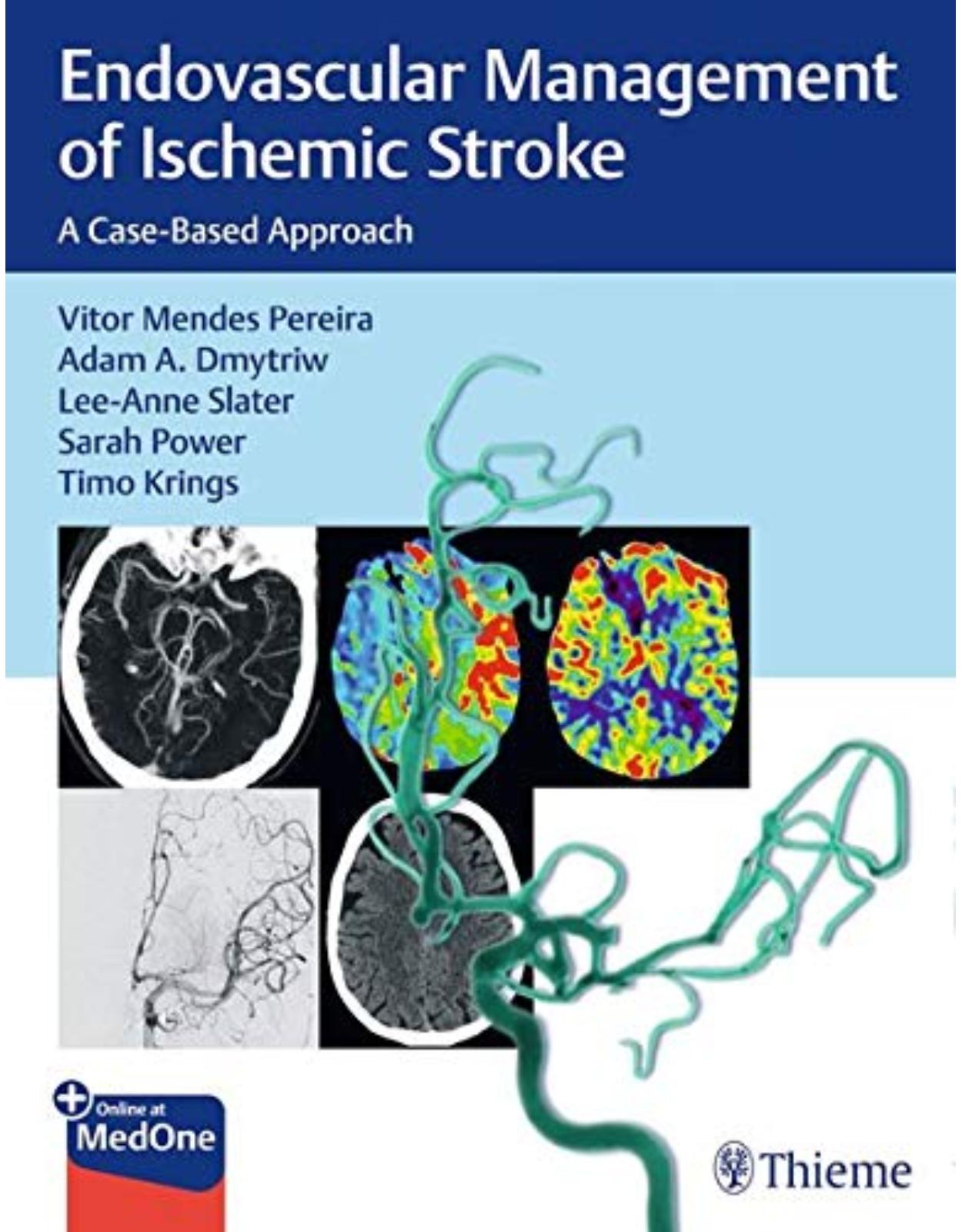 Endovascular Management of Ischemic Stroke: A Case-Based Approach 