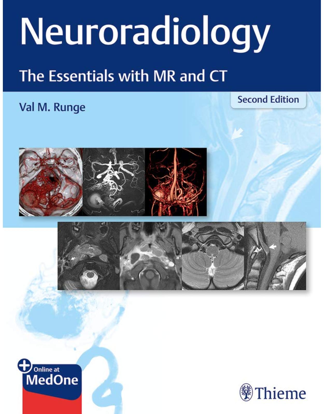 Neuroradiology: The Essentials with MR and CT