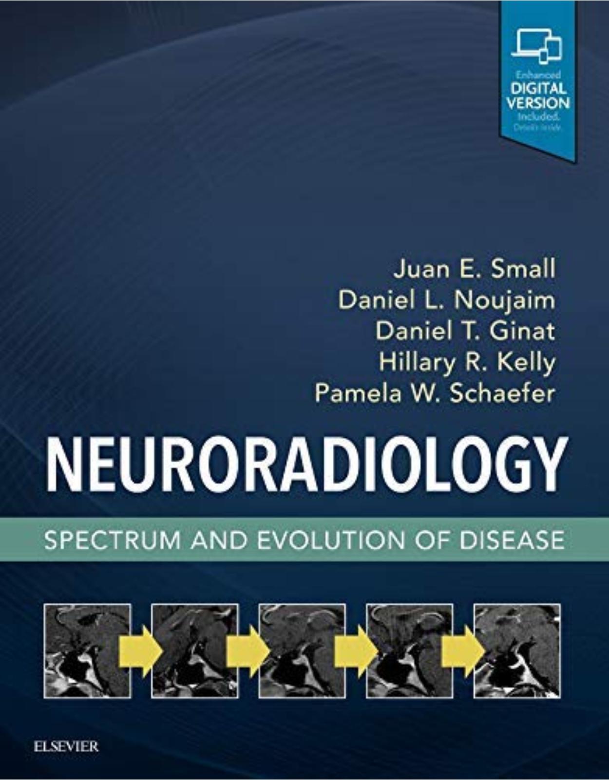 Neuroradiology: Spectrum and Evolution of Disease, 1e
