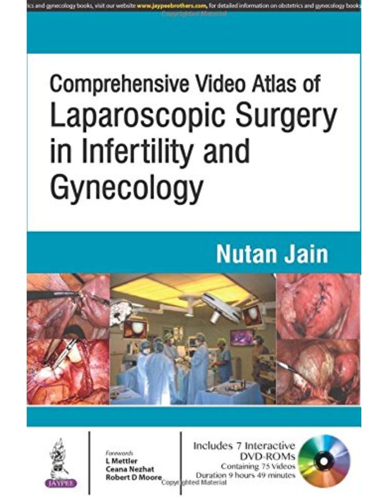 Comprehensive Video Atlas of Laparoscopic Surgery in Infertility and Gynecology