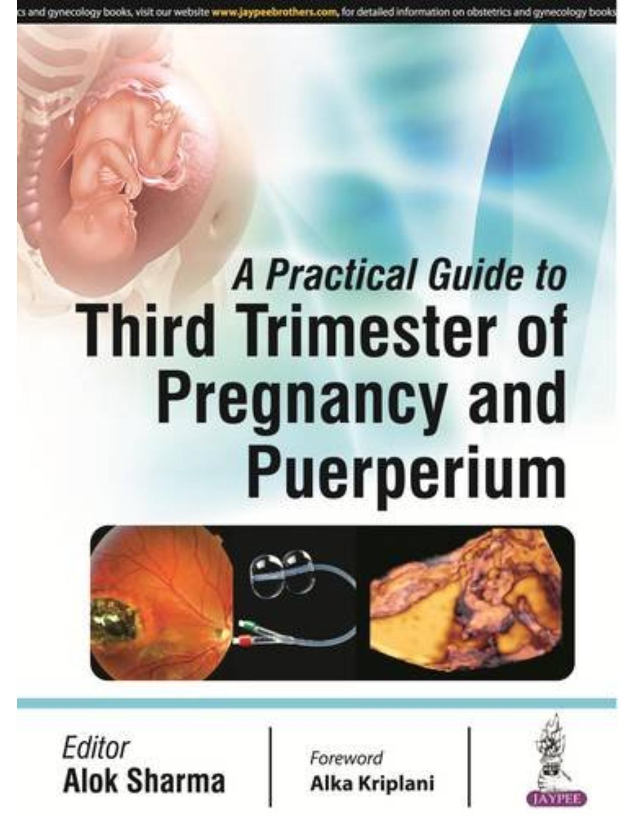  A Practical Guide to Third Trimester of Pregnancy & Puerperium