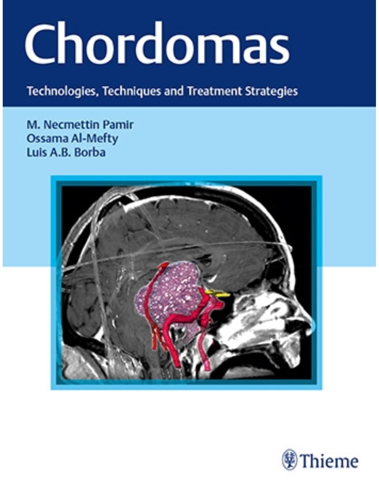 Chordomas: Technologies, Techniques, and Treatment Strategies