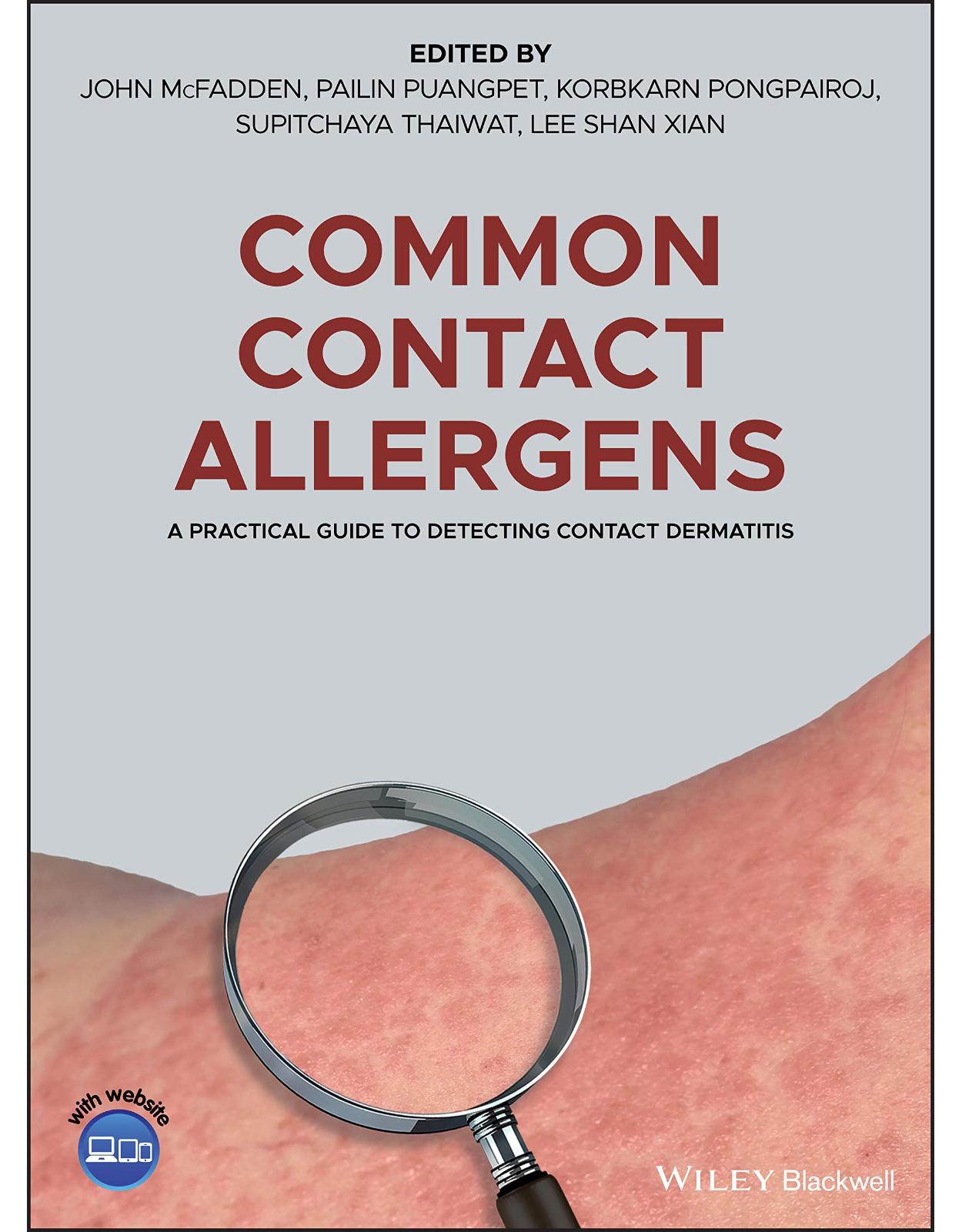 Common Contact Allergens: A Practical Guide to Detecting Contact Dermatitis