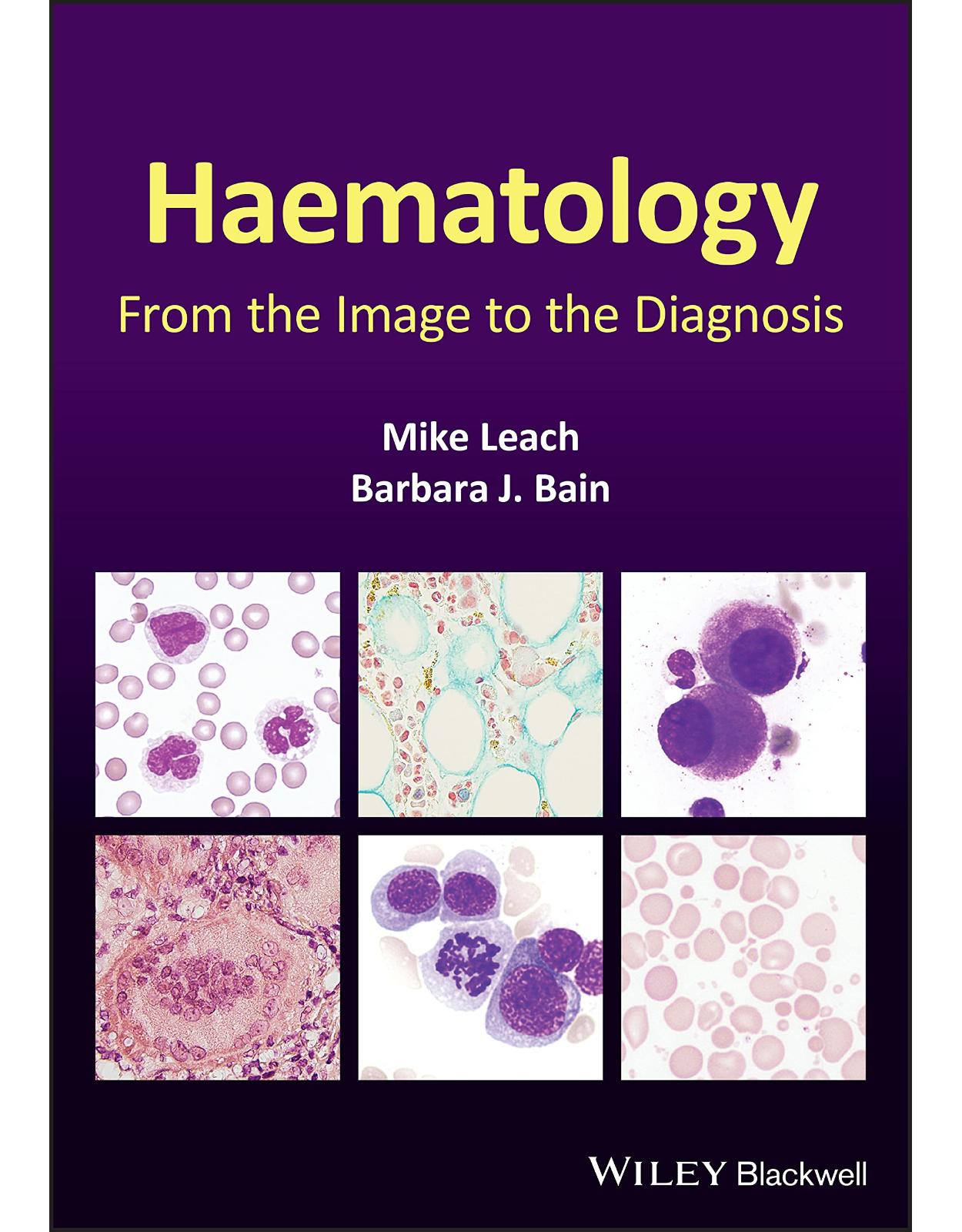 Haematology: From the Image to the Diagnosis